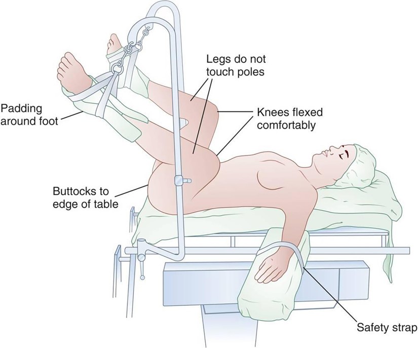 surgery position